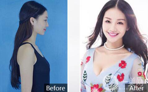 2018湛江華美整形醫(yī)院價格（目）表年終鉅惠版全新一覽