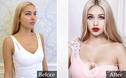 2018湛江華美整形醫(yī)院價格（目）表年終鉅惠版全新一覽