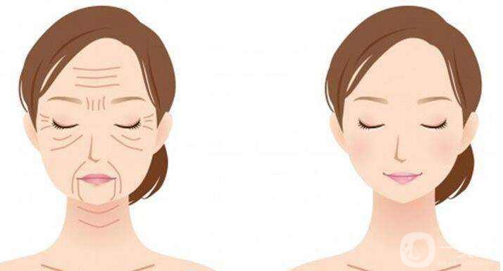 去除抬頭紋,方法