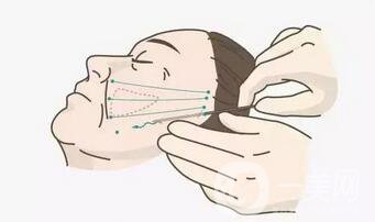 微創(chuàng)面部*手術(shù)價格是多少