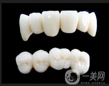 深圳做烤瓷牙一般要多少錢(qián)