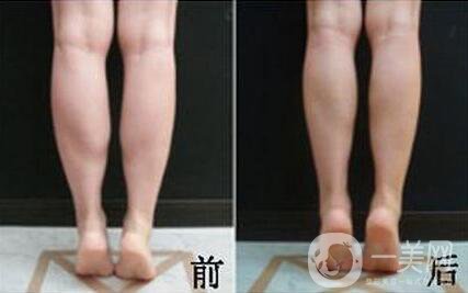 *的副作用有哪些？