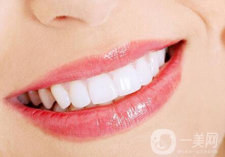 *潔牙多少錢一次？