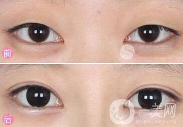 *都包含哪些項目？*整形多少錢