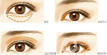 *都包含哪些項目？*整形多少錢