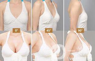 自體隆胸后多久可以上班？術(shù)后有哪些注意事項(xiàng)