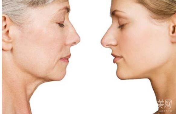 小切口拉皮除皺術(shù)