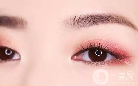 全切雙眼皮肉條多久消？