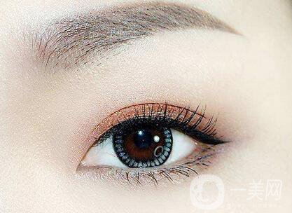 全切雙眼皮肉條多久消？