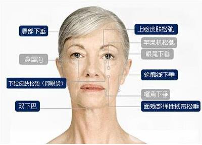 面部提升,多少錢