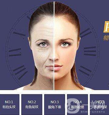 北京,面部提升,多少錢