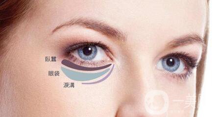 內(nèi)切祛眼袋術后護理主要有哪幾點？