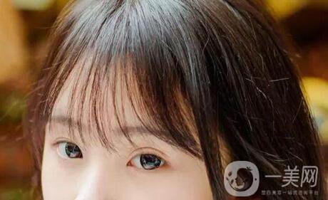 開(kāi)眼角幾天可以拆線？術(shù)后注意事項(xiàng)盤點(diǎn)！