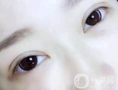 埋線后注意事項(xiàng)有哪些？