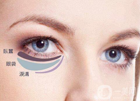 內(nèi)切眼袋真實(shí)恢復(fù)過程，術(shù)后注意事項(xiàng)