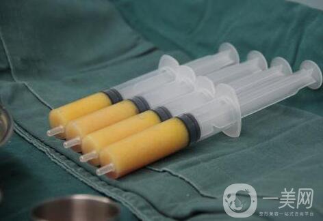 自體脂肪隆胸后多久可以恢復(fù)上班？