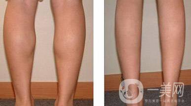 深圳,**,多少錢呢