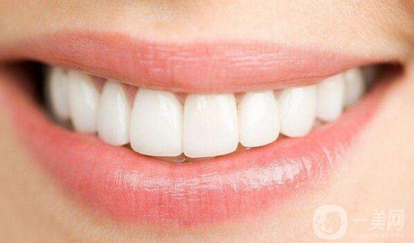 上海做貴金屬烤瓷牙多少錢(qián)