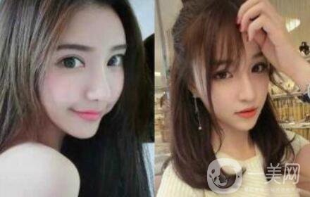 上海整形醫(yī)院做磨骨手術(shù)多少錢