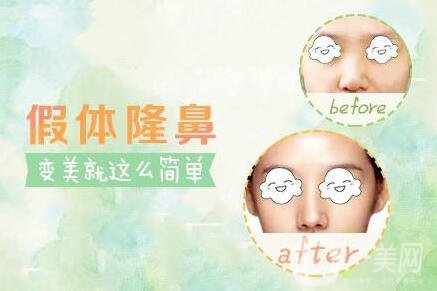 硅膠隆鼻可以維持一生嗎？