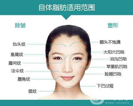 自體脂肪填充后*忌諱什么