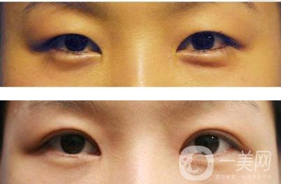 *整形手術(shù)術(shù)前準(zhǔn)備要做些什么