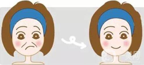 面部注射*除皺*果好不好 怎么樣