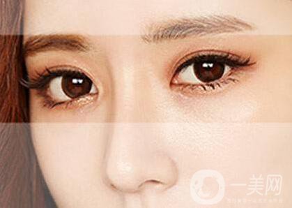 *術(shù)后注意事項(xiàng)有哪些？