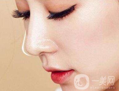 隆鼻能保持一輩子嗎？