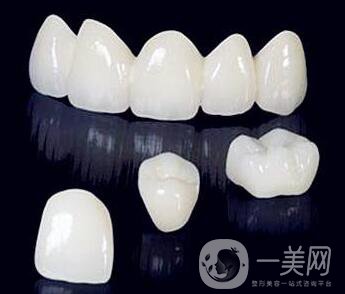 非貴金屬烤瓷牙好不好