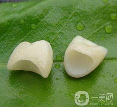 金鈀合金烤瓷牙價格多少錢？