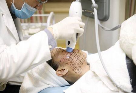 熱瑪吉緊膚除皺價(jià)格多少錢？