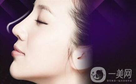 成都肋軟骨隆鼻價(jià)格需要多少錢