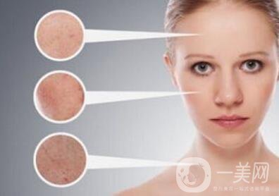 黃褐斑的形成原因是什么？