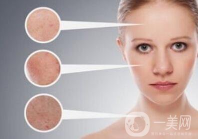 像素激光祛斑價格多少錢？