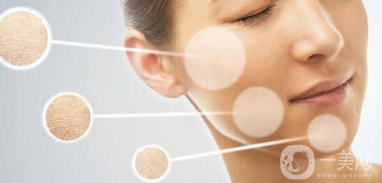 花斑癬調節(jié)方法有哪些？