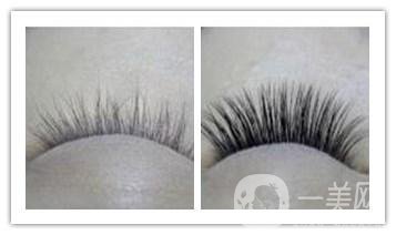 睫毛移植手術(shù)*果怎么樣 *果*嗎