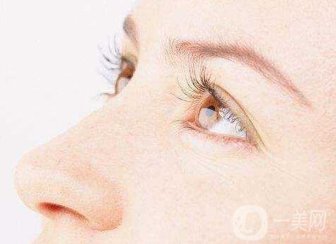 埋線雙眼皮5天能消腫嗎？