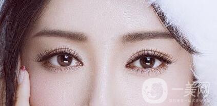 全切雙眼皮多久恢復(fù)？