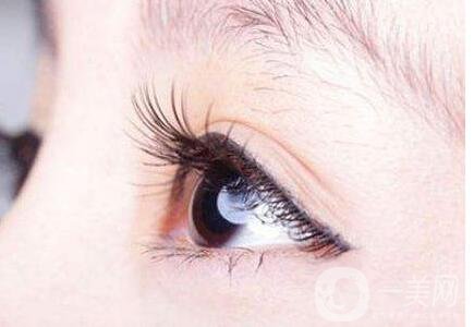 埋線雙眼皮,埋線雙眼皮價(jià)格,埋線雙眼皮忌口多久