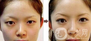 *手術(shù)前準(zhǔn)備有哪些