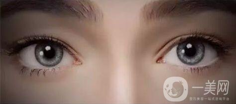 割雙眼皮,割雙眼皮多少錢,武漢割雙眼皮多少錢