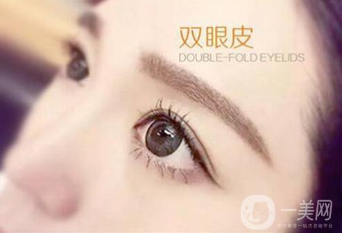 割雙眼皮,割雙眼皮多少錢,武漢割雙眼皮多少錢