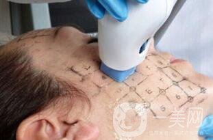 北京熱瑪吉一次多少錢