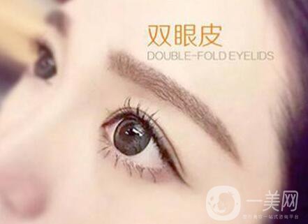 割雙眼皮痕跡多久消失？