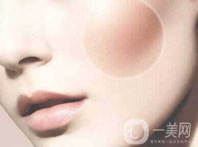 顴骨手術(shù)多長(zhǎng)時(shí)間恢復(fù)？