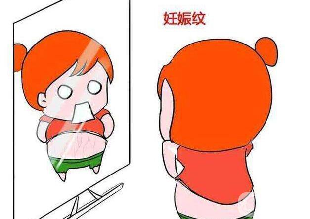 激光去妊娠紋,激光去妊娠紋費用,深圳激光去妊娠紋費用