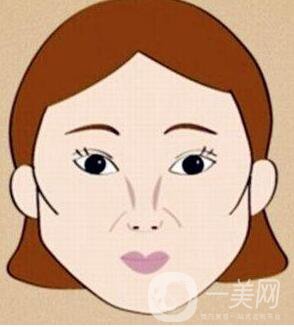 顴骨降低,顴骨降低手術(shù)多少錢,北京顴骨降低手術(shù)多少錢