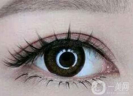 上海開(kāi)眼角手術(shù)的費(fèi)用是多少？