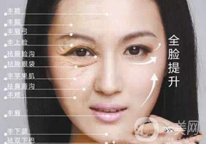 電波拉皮多長時間做一次？